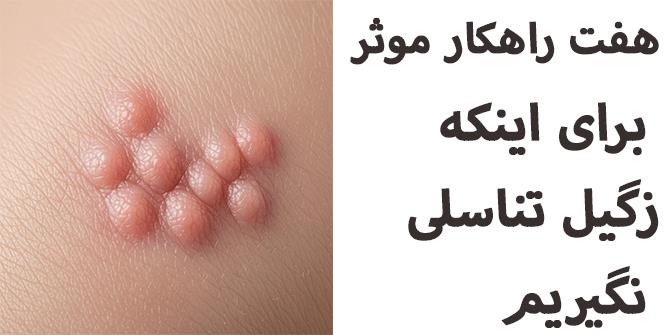 هفت راهكار موثر براي  اينكه زگيل تناسلي نگيريم
