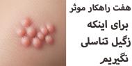 هفت راهكار موثر براي  اينكه زگيل تناسلي نگيريم
